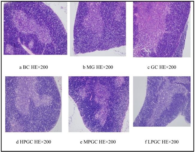 perimenopausal syndrome 
