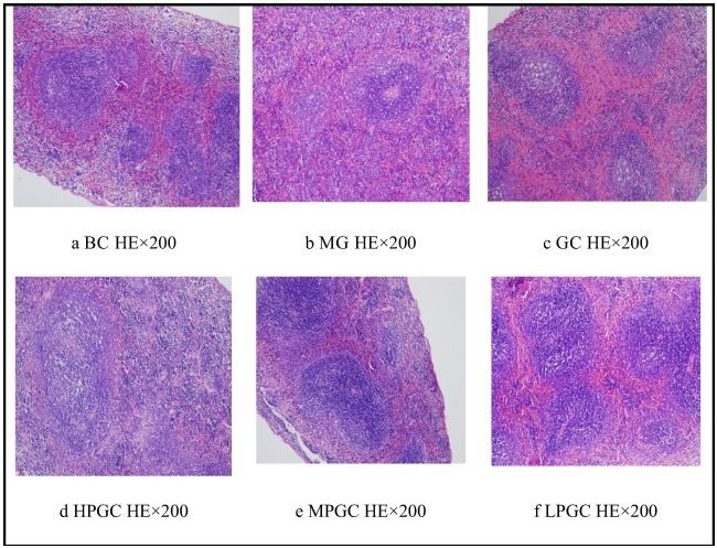perimenopausal syndrome 