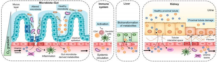 Figure 2. Overview of Microbiota–Gut–(Immune System–Liver)–Kidney Axis Interactions in the Development of Chronic Kidney Disease (CKD).