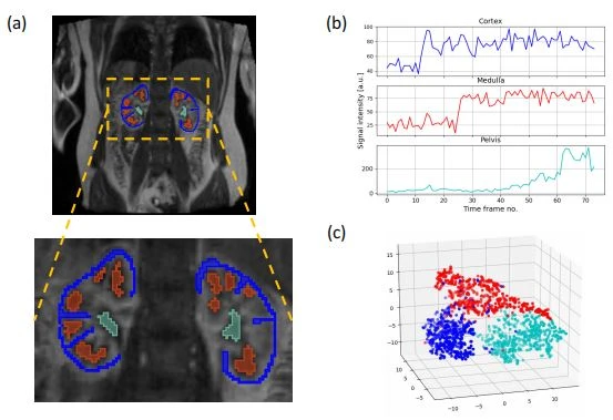 Figure 4. Preparation of training data for supervised learning of classifiers: (a) ROI placement in a DCE-MRI frame;