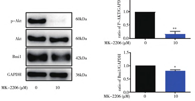 Figure 4: The effect of Akt inhibitor on Bmi1. Western blot experiment was used to detect the expression of phosphorylated Akt and Bmi1 in mouse spermatogonial stem cells after 24 hours of Akt inhibitor treatment, and the statistical diagram was presented* P<0.05 * * P<0.01, compared to the control group, n=3. Figure 4: The effect of Akt inhibitor on Bmi1. Western blot experiment was used to detect the expression of phosphorylated Akt and Bmi1 in mouse spermatogonial stem cells after 24 hours of Akt inhibitor treatment, and the statistical diagram was presented* P<0.05 * * P<0.01, compared to the control group, n=3.